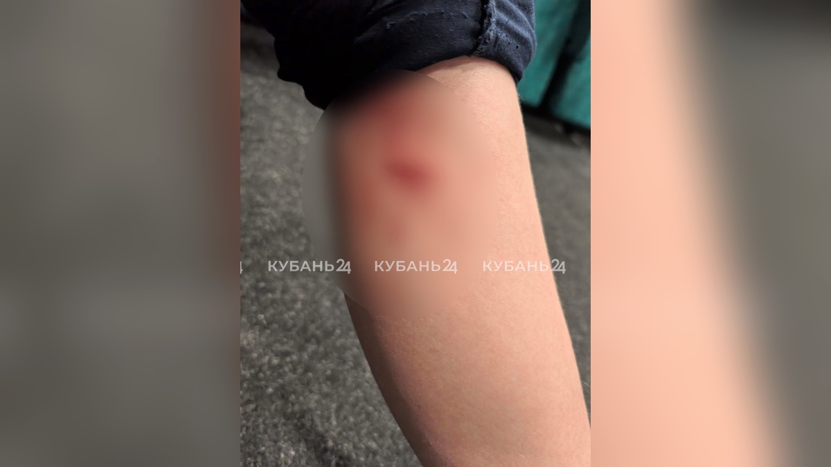Появилось видео момента нападения бродячей собаки на школьника в Краснодаре