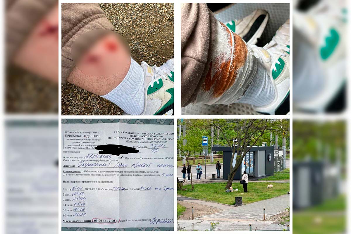 СК возбудил дело о нападении бездомной собаки на подростка в Краснодаре