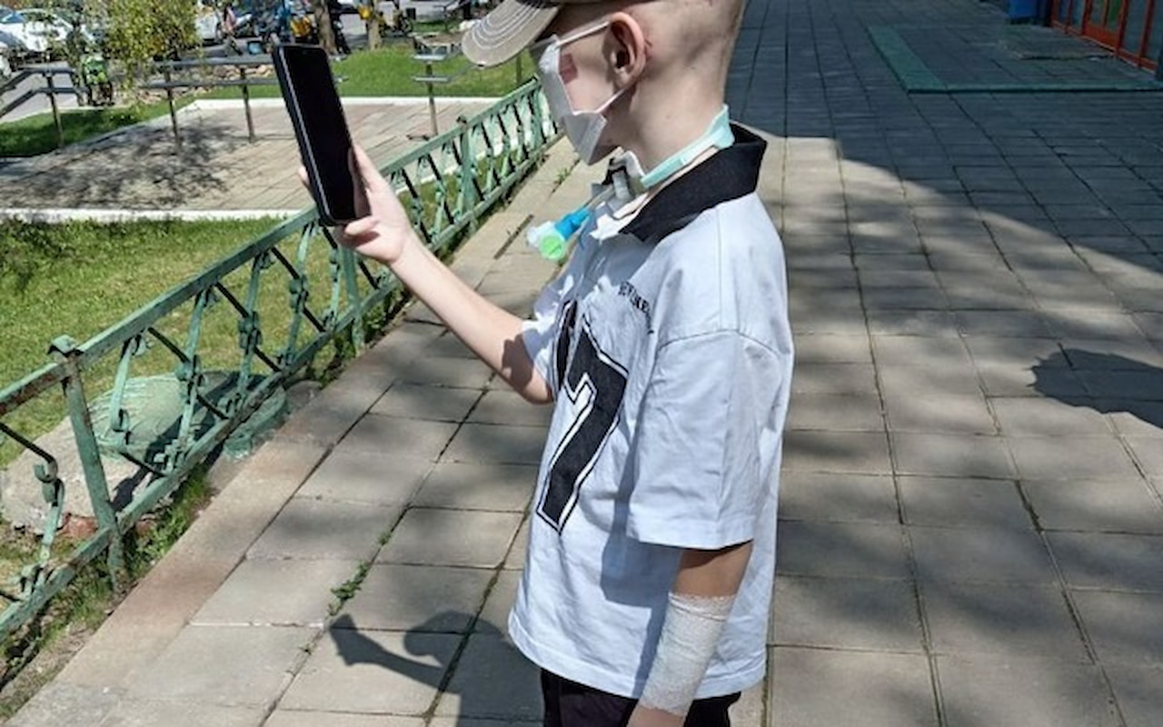 Суд арестовал имущество хозяина хаски, разорвавших лицо мальчика в Сочи